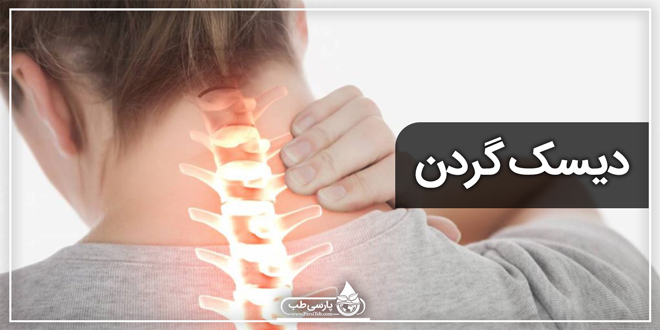 درمان دیسک گردن در منزل
